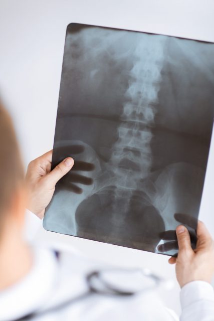Close,Up,Of,Male,Doctor,Holding,X-ray,Or,Roentgen,Image
